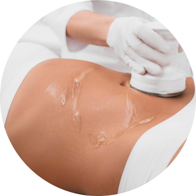 Ultrasound Fat Cavitation